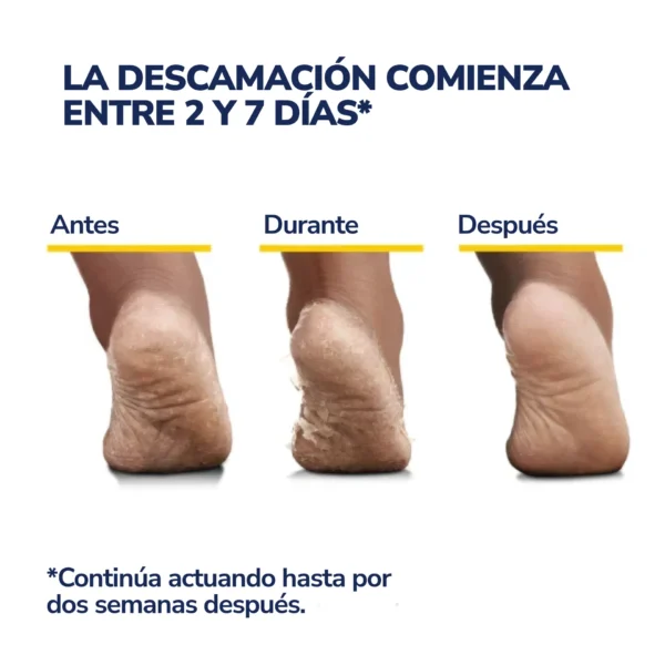 Mascarilla Exfoliante para Pies Dr. Scholl's - Pies Suaves